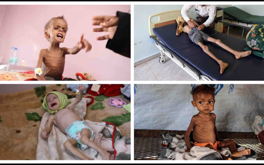 ONU Organisation des Nations unies malnutrition